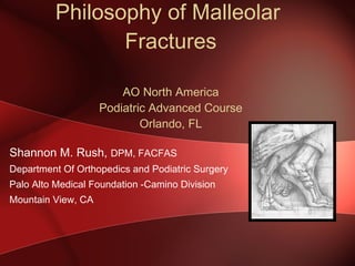 Philosophy of Malleolar  Fractures AO North America Podiatric Advanced Course Orlando, FL ,[object Object],[object Object],[object Object],[object Object]