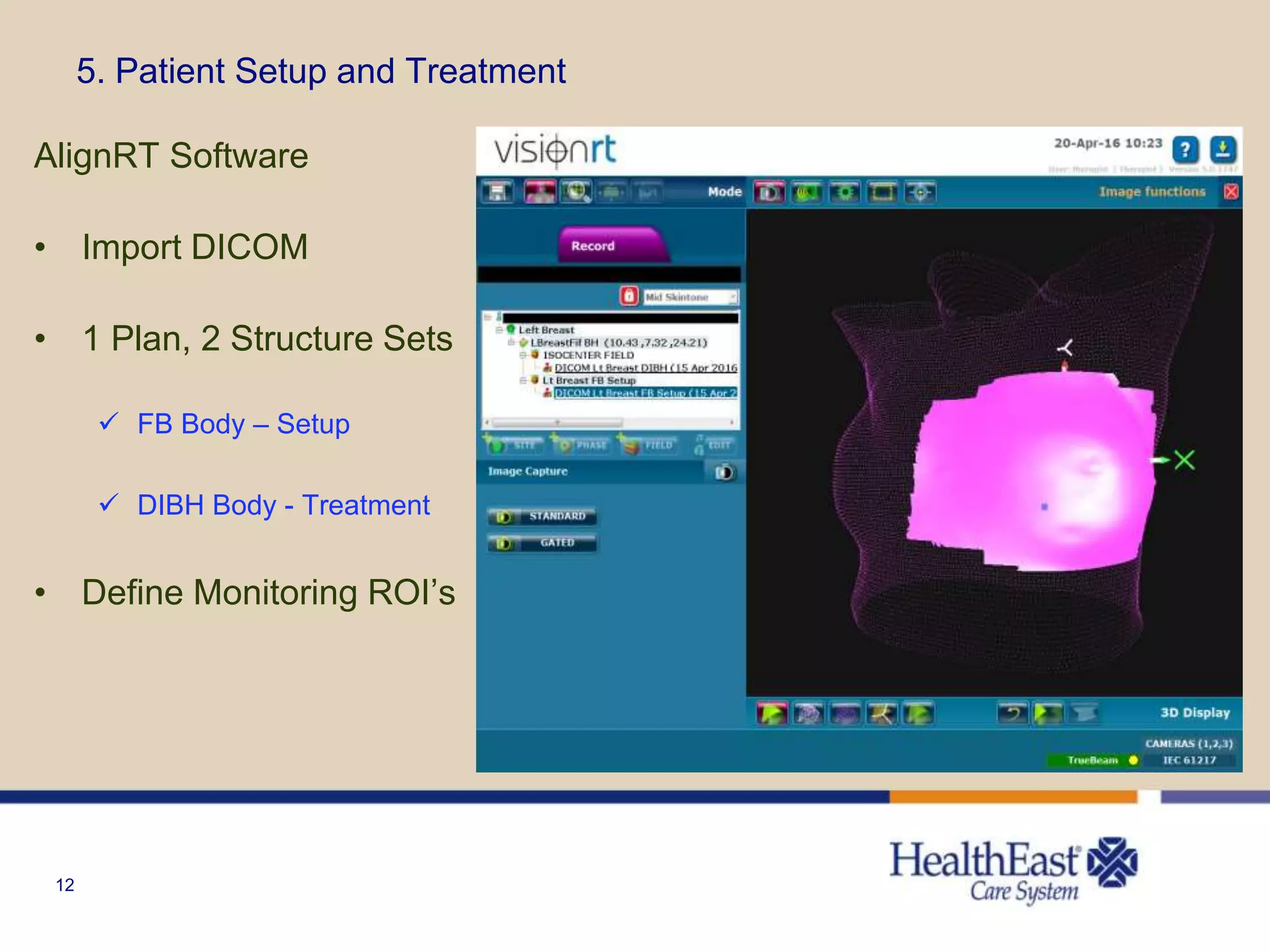 12
5. Patient Setup and Treatment
AlignRT Software
• Import DICOM
• 1 Plan, 2 Structure Sets
 FB Body – Setup
 DIBH Body - Treatment
• Define Monitoring ROI’s
 