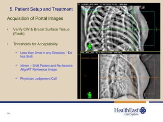 14
5. Patient Setup and Treatment
Acquisition of Portal Images
• Verify CW & Breast Surface Tissue
(Flash)
• Thresholds for Acceptability
 Less than 3mm in any Direction – Do
Not Shift
 ≥5mm – Shift Patient and Re-Acquire
AlignRT Reference Image
 Physician Judgement Call
 