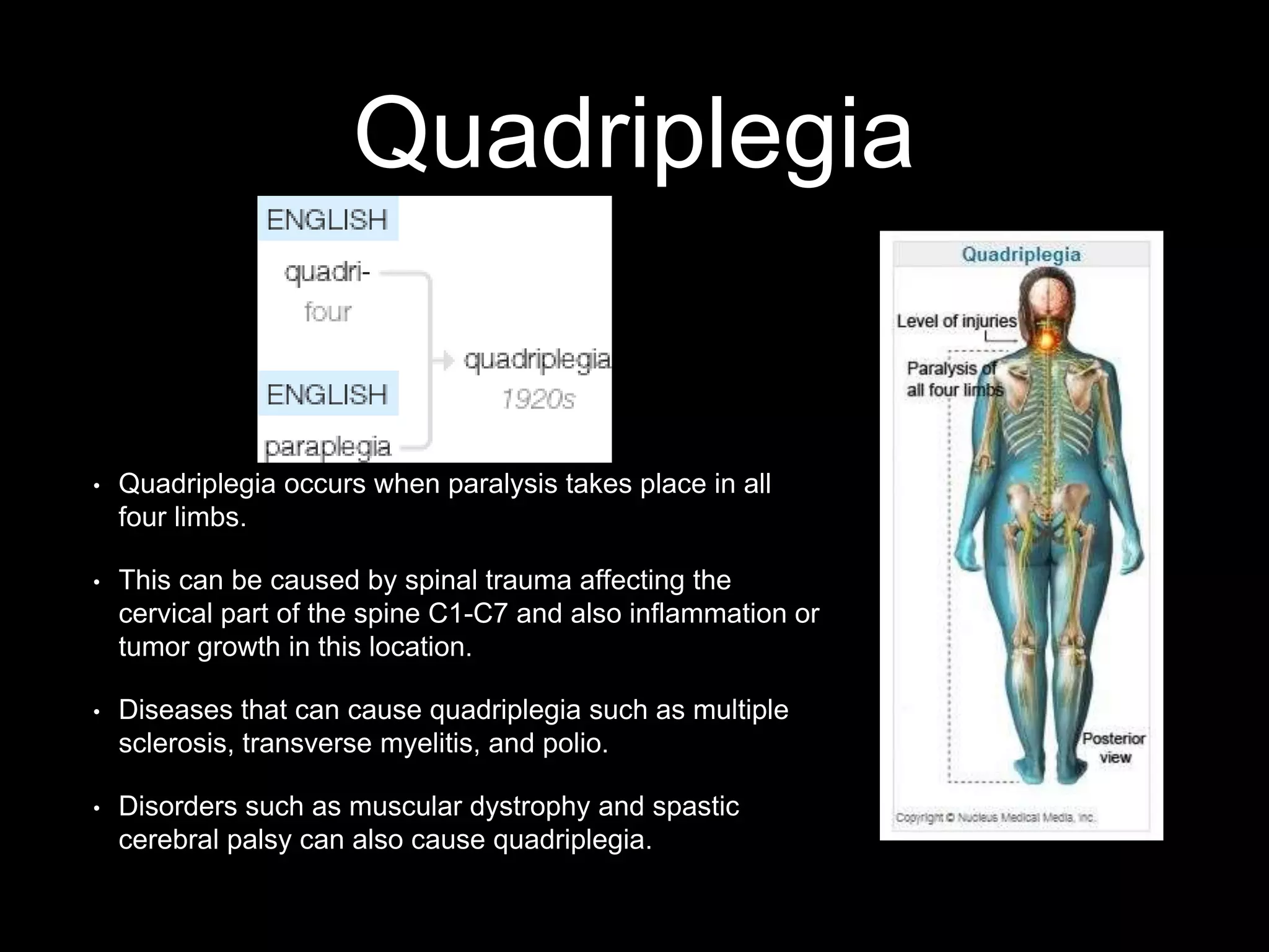 Quadriplegia
• Quadriplegia occurs when paralysis takes place in all
four limbs.
• This can be caused by spinal trauma affecting the
cervical part of the spine C1-C7 and also inflammation or
tumor growth in this location.
• Diseases that can cause quadriplegia such as multiple
sclerosis, transverse myelitis, and polio.
• Disorders such as muscular dystrophy and spastic
cerebral palsy can also cause quadriplegia.
 