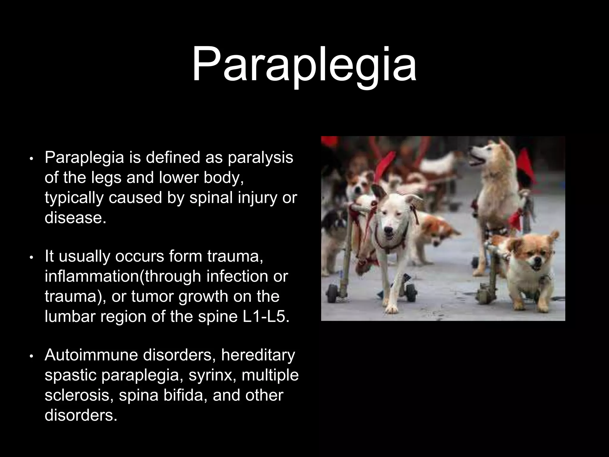 Paraplegia
• Paraplegia is defined as paralysis
of the legs and lower body,
typically caused by spinal injury or
disease.
• It usually occurs form trauma,
inflammation(through infection or
trauma), or tumor growth on the
lumbar region of the spine L1-L5.
• Autoimmune disorders, hereditary
spastic paraplegia, syrinx, multiple
sclerosis, spina bifida, and other
disorders.
 