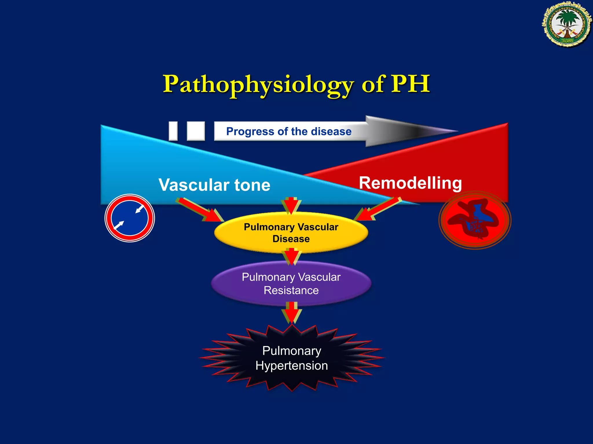 Pulmonary Hypertension associated with Connective Tissue Disease. | PDF