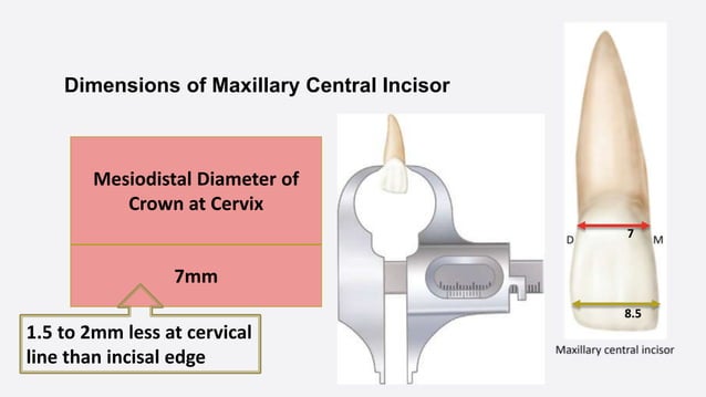 Morphology of Permanent Maxillary Central Incisor- Dr. Saba Arshad.pptx ...