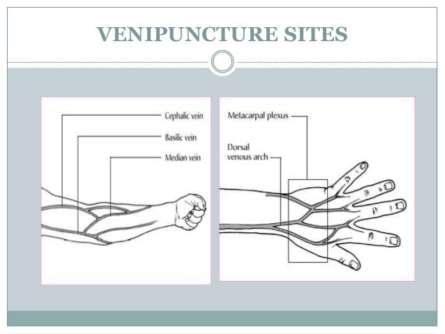 venipuncture sites diagram venipuncture sites diagram