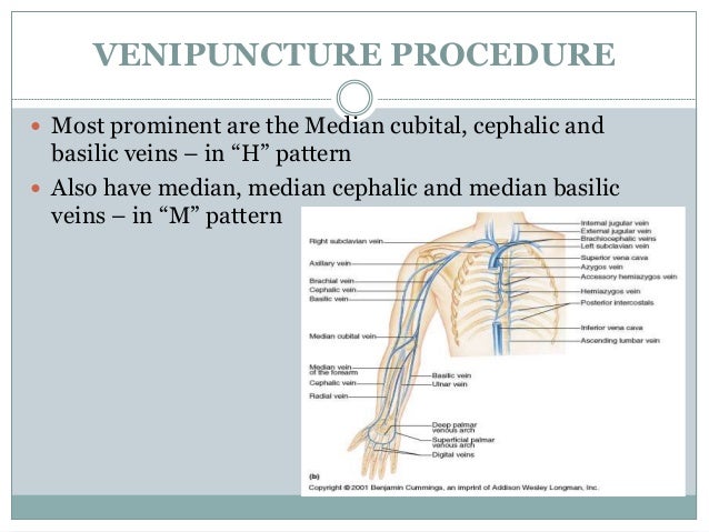 Phlebotomy diagram of veins in your arm 