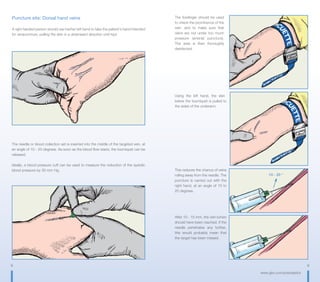 8 9
www.gbo.com/preanalytics
The forefinger should be used
to check the prominence of the
vein, and to make sure that
veins are not under too much
pressure (arterial puncture).
The area is then thoroughly
disinfected.
Using the left hand, the skin
below the tourniquet is pulled to
the sides of the underarm.
This reduces the chance of veins
rolling away from the needle. The
puncture is carried out with the
right hand, at an angle of 10 to
20 degrees.
After 10 - 15 mm, the vein lumen
should have been reached. If the
needle penetrates any further,
this would probably mean that
the target has been missed.
Puncture site: Dorsal hand veins
A right handed person should use his/her left hand to take the patient‘s hand intended
for venipuncture, pulling the skin in a downward direction until taut.
The needle or blood collection set is inserted into the middle of the targeted vein, at
an angle of 10 - 20 degrees. As soon as the blood flow starts, the tourniquet can be
released.
Ideally, a blood pressure cuff can be used to measure the reduction of the systolic
blood pressure by 30 mm Hg.
10 - 20 °
 