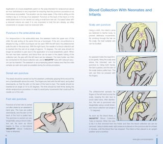 16 17
www.gbo.com/preanalytics
Application of a local anaesthetic patch on the area intended for venipuncture about
an hour beforehand is very important for ensuring that the puncture procedure is as
harmonious as possible. The situation can be made easier, if the child is sitting on the
mother‘s lap or on the lap of an assistant. Puncture on the back of the hand or in the
antecubital area is to be carried out using a small bore vein set. Evcuated tubes with
a reduced volume are used. It is very important to hold the arm steady, as reflex
movements to escape must be reckoned with.
Puncture in the antecubital area
For venipuncture in the antecubital area, the assistant holds the upper arm of the
child, the grip acting at the same time as a tourniquet. If the arm circumference is
already too big, a child‘s tourniquet can be used. With the left hand, the phlebotomist
pulls the skin in this area taut. With the right hand, the needle of a blood collection set
is inserted into the vein at an angle of approx. 15 degrees. The vein area should no
longer be sensitive to pain due to the application of a local anaesthetic patch. When
the vein has been reached, and blood flow can be seen in the plastic tubing of the
collection set, the grip with the left hand can be released. The tube holder can then
be connected to the blood collection set, and a VACUETTE®
tube with reduced vacu-
um can be inserted. The assistant or accompanying parent makes sure that the child
remains as calm and quiet as possible during the whole procedure.
Dorsal vein puncture
The stasis should be carried out by the assistant, preferably gripping firmly around the
arm a handbreadth above the wrist. The fingers are held with the left hand, and pulled
downwards, so that the skin on the back of the hand is taut. The needle should be
inserted at an angle of 10 to 20 degrees. The limb should be held firmly during the
whole venipuncture procedure, in order to avoid jerky movements that could pull the
needle out of the vein.
Foot vein puncture
Puncture of a foot vein is carried
out after stasis by an assistant‘s
hand grip. The toes are pulled
downwards, and the skin on the
back of the foot is pulled taut.
The puncture is carried out very
tangentially using a blood collec-
tion set. As soon as blood
begins to flow, a low-volume
VACUETTE®
Blood Collection
Tube is attached.
Blood Collection With Neonates and
Infants
Scalp vein puncture
Using a cloth, the infant‘s arms
are fastened to his/her body, to
prevent defensive movements.
By combing through the hair on
the scalp, the best suitable vein
can be located.
An assistant holds the head firm-
ly but gently, fixing the scalp area
where the intended vein for
puncture is. Using both hands,
the hair is parted, and the skin of
the scalp below pulled taut. The
vein can then be pressed with
the fingers.
The phlebotomist spreads his
fingers of the left hand across the
scalp, keeping the skin taut to
avoid rolled veins. After disinfec-
tion, the vein is punctured very
tangentially using a small dimen-
sion blood collection set (angle 5
- 10 degrees).
As soon as the blood flows, a
VACUETTE®
Blood Collection
Tube is inserted. When the tube
is full, it is first removed from the holder and then the blood collection set can be
removed. Using a sterile swab, light pressure is placed on the puncture site for at least
2 minutes, until the blood flow has stopped. The infant is then placed in an upright
position and is soothed.
 