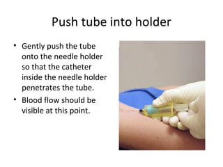 Push tube into holder
• Gently push the tube
onto the needle holder
so that the catheter
inside the needle holder
penetrates the tube.
• Blood flow should be
visible at this point.
 