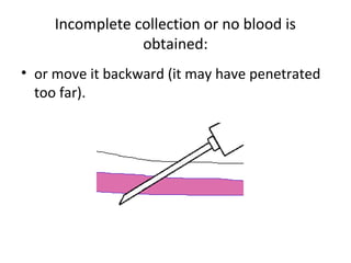 Incomplete collection or no blood is
obtained:
• or move it backward (it may have penetrated
too far).
 