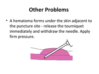 Other Problems
• A hematoma forms under the skin adjacent to
the puncture site - release the tourniquet
immediately and withdraw the needle. Apply
firm pressure.
 