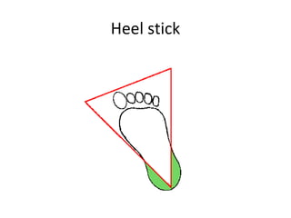 Heel stick
 