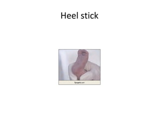 Heel stick
 