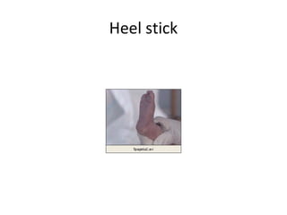 Heel stick
 