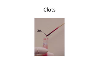Clots
 