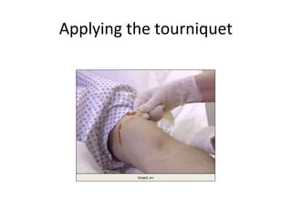 Applying the tourniquet
 