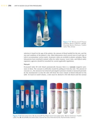 206 UNIT III: BLOOD COLLECTION PROCEDURES
selection is based on the age of the patient, the amount of blood needed for the test, and the
size and condition of the patient’s vein. Most laboratories stock several sizes of each type of
tube to accommodate various needs. At present, tubes are available in plastic and glass. Many
laboratories have switched to plastic tubes for safety reasons. Local, state, and federal safety
regulatory agencies should be consulted for current applicable regulations.
Vacuum
Evacuated tubes ﬁll with blood automatically because there is a vacuum (negative pres-
sure) in them. The vacuum is artiﬁcially created by pulling air from the tube. The amount of
vacuum (i.e., the amount of air removed and negative pressure created) is measured precisely
by the manufacturer so that the tube will draw the exact volume of blood indicated on the
label. To reach its stated volume, a tube must be allowed to ﬁll with blood until the normal
Figure 7-17 BD Vacutainer®
Passive
Shielding Blood Collection Needle.
(Courtesy Becton Dickinson, Franklin
Lakes, New Jersey)
A
B
Figure 7-18 Evacuated tubes. A. Vacutainer® Plus Plastic brand evacuated tubes. (Becton Dickinson, Franklin
Lakes, NJ.) B. Vacuette® evacuated tubes. (Greiner Bio-One International AG, Kremsmünster, Austria.)
 