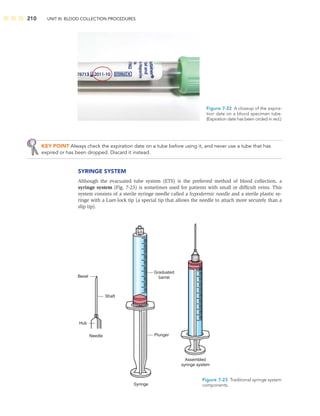 210 UNIT III: BLOOD COLLECTION PROCEDURES
KEY POINT Always check the expiration date on a tube before using it, and never use a tube that has
expired or has been dropped. Discard it instead.
SYRINGE SYSTEM
Although the evacuated tube system (ETS) is the preferred method of blood collection, a
syringe system (Fig. 7-23) is sometimes used for patients with small or difﬁcult veins. This
system consists of a sterile syringe needle called a hypodermic needle and a sterile plastic sy-
ringe with a Luer-lock tip (a special tip that allows the needle to attach more securely than a
slip tip).
Figure 7-22 A closeup of the expira-
tion date on a blood specimen tube.
(Expiration date has been circled in red.)
Graduated
barrel
Plunger
Shaft
Bevel
Hub
Needle
Syringe
Assembled
syringe system
Figure 7-23 Traditional syringe system
components.
 