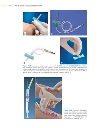 214 UNIT III: BLOOD COLLECTION PROCEDURES
C
B
D
A
Figure 7-27 Examples of safety-winged infusion sets. A. BD Vacutainer®
SAFETY-LOK™ Blood Collec-
tion Set for use with the evacuated tube system. (Courtesy Becton Dickinson Vacutainer Systems, Franklin
Lakes, NJ.) B. Monoject Angel Wing blood collection set. (Kendall CO, LP, Mansﬁeld, MA.) C. Vacuette®
safety butterﬂy blood collection system (Greiner Bio-One, Kremsmünster, Austria.) D. Vacutainer®
Push
Button Blood Collection Set. (Courtesy Becton Dickinson, Franklin Lakes, NJ.)
Figure 7-28 Sarstedt S-Monovette®
venous blood collection system. Left:
System with needle attached. Upper
right: System used as a syringe. Lower
right: System used as ETS. (Courtesy
of Sarstedt, Inc., Newton, NC.)
 