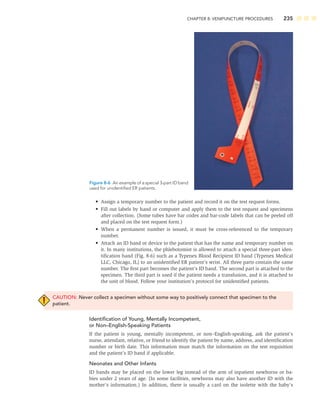 CHAPTER 8: VENIPUNCTURE PROCEDURES 235
• Assign a temporary number to the patient and record it on the test request forms.
• Fill out labels by hand or computer and apply them to the test request and specimens
after collection. (Some tubes have bar codes and bar-code labels that can be peeled off
and placed on the test request form.)
• When a permanent number is issued, it must be cross-referenced to the temporary
number.
• Attach an ID band or device to the patient that has the name and temporary number on
it. In many institutions, the phlebotomist is allowed to attach a special three-part iden-
tiﬁcation band (Fig. 8-6) such as a Typenex Blood Recipient ID band (Typenex Medical
LLC, Chicago, IL) to an unidentiﬁed ER patient’s wrist. All three parts contain the same
number. The ﬁrst part becomes the patient’s ID band. The second part is attached to the
specimen. The third part is used if the patient needs a transfusion, and it is attached to
the unit of blood. Follow your institution’s protocol for unidentiﬁed patients.
CAUTION: Never collect a specimen without some way to positively connect that specimen to the
patient.
Identiﬁcation of Young, Mentally Incompetent,
or Non–English-Speaking Patients
If the patient is young, mentally incompetent, or non–English-speaking, ask the patient’s
nurse, attendant, relative, or friend to identify the patient by name, address, and identiﬁcation
number or birth date. This information must match the information on the test requisition
and the patient’s ID band if applicable.
Neonates and Other Infants
ID bands may be placed on the lower leg instead of the arm of inpatient newborns or ba-
bies under 2 years of age. (In some facilities, newborns may also have another ID with the
mother’s information.) In addition, there is usually a card on the isolette with the baby’s
Figure 8-6 An example of a special 3-part ID band
used for unidentiﬁed ER patients.
 