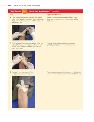 242 UNIT III: BLOOD COLLECTION PROCEDURES
Step Explanation/Rationale
6. Cross the left end over the right end near the left If there is too much space between the left index
index ﬁnger, grasping both sides together between ﬁnger and the patient’s arm, the tourniquet will be
the thumb and foreﬁnger of the left hand, close to too loose.
the patient’s arm.
7. While securely grasping both sides, use either the The loop allows the tourniquet to be released
left middle ﬁnger or the right index ﬁnger to tuck a quickly by a slight tug on the end that forms it.
portion of the left side under the right side and
pull it into a loop.
8. A properly tied tourniquet with the The tourniquet ends should point toward the shoulder to
ends pointing toward the shoulder. prevent them from contaminating the blood collection site.
PROCEDURE 8-1 Tourniquet Application (Continued)
 