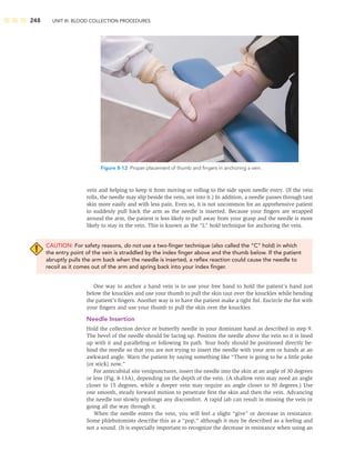 248 UNIT III: BLOOD COLLECTION PROCEDURES
vein and helping to keep it from moving or rolling to the side upon needle entry. (If the vein
rolls, the needle may slip beside the vein, not into it.) In addition, a needle passes through taut
skin more easily and with less pain. Even so, it is not uncommon for an apprehensive patient
to suddenly pull back the arm as the needle is inserted. Because your ﬁngers are wrapped
around the arm, the patient is less likely to pull away from your grasp and the needle is more
likely to stay in the vein. This is known as the “L” hold technique for anchoring the vein.
CAUTION: For safety reasons, do not use a two-ﬁnger technique (also called the “C” hold) in which
the entry point of the vein is straddled by the index ﬁnger above and the thumb below. If the patient
abruptly pulls the arm back when the needle is inserted, a reﬂex reaction could cause the needle to
recoil as it comes out of the arm and spring back into your index ﬁnger.
One way to anchor a hand vein is to use your free hand to hold the patient’s hand just
below the knuckles and use your thumb to pull the skin taut over the knuckles while bending
the patient’s ﬁngers. Another way is to have the patient make a tight ﬁst. Encircle the ﬁst with
your ﬁngers and use your thumb to pull the skin over the knuckles.
Needle Insertion
Hold the collection device or butterﬂy needle in your dominant hand as described in step 9.
The bevel of the needle should be facing up. Position the needle above the vein so it is lined
up with it and paralleling or following its path. Your body should be positioned directly be-
hind the needle so that you are not trying to insert the needle with your arm or hands at an
awkward angle. Warn the patient by saying something like “There is going to be a little poke
(or stick) now.”
For antecubital site venipunctures, insert the needle into the skin at an angle of 30 degrees
or less (Fig. 8-13A), depending on the depth of the vein. (A shallow vein may need an angle
closer to 15 degrees, while a deeper vein may require an angle closer to 30 degrees.) Use
one smooth, steady forward motion to penetrate ﬁrst the skin and then the vein. Advancing
the needle too slowly prolongs any discomfort. A rapid jab can result in missing the vein or
going all the way through it.
When the needle enters the vein, you will feel a slight “give” or decrease in resistance.
Some phlebotomists describe this as a “pop,” although it may be described as a feeling and
not a sound. (It is especially important to recognize the decrease in resistance when using an
Figure 8-12 Proper placement of thumb and ﬁngers in anchoring a vein.
 