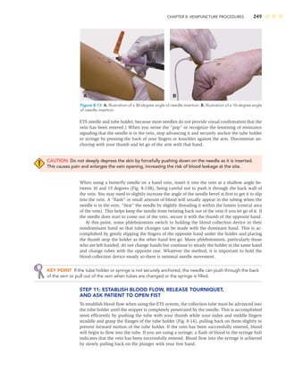 CHAPTER 8: VENIPUNCTURE PROCEDURES 249
ETS needle and tube holder, because most needles do not provide visual conﬁrmation that the
vein has been entered.) When you sense the “pop” or recognize the lessening of resistance
signaling that the needle is in the vein, stop advancing it and securely anchor the tube holder
or syringe by pressing the back of your ﬁngers or knuckles against the arm. Discontinue an-
choring with your thumb and let go of the arm with that hand.
CAUTION: Do not deeply depress the skin by forcefully pushing down on the needle as it is inserted.
This causes pain and enlarges the vein opening, increasing the risk of blood leakage at the site.
When using a butterﬂy needle on a hand vein, insert it into the vein at a shallow angle be-
tween 10 and 15 degrees (Fig. 8-13B), being careful not to push it through the back wall of
the vein. You may need to slightly increase the angle of the needle bevel at ﬁrst to get it to slip
into the vein. A “ﬂash” or small amount of blood will usually appear in the tubing when the
needle is in the vein. “Seat” the needle by slightly threading it within the lumen (central area
of the vein). This helps keep the needle from twisting back out of the vein if you let go of it. If
the needle does start to come out of the vein, secure it with the thumb of the opposite hand.
At this point, some phlebotomists switch to holding the blood collection device in their
nondominant hand so that tube changes can be made with the dominant hand. This is ac-
complished by gently slipping the ﬁngers of the opposite hand under the holder and placing
the thumb atop the holder as the other hand lets go. Many phlebotomists, particularly those
who are left-handed, do not change hands but continue to steady the holder in the same hand
and change tubes with the opposite one. Whatever the method, it is important to hold the
blood-collection device steady so there is minimal needle movement.
KEY POINT If the tube holder or syringe is not securely anchored, the needle can push through the back
of the vein or pull out of the vein when tubes are changed or the syringe is ﬁlled.
STEP 11: ESTABLISH BLOOD FLOW, RELEASE TOURNIQUET,
AND ASK PATIENT TO OPEN FIST
To establish blood ﬂow when using the ETS system, the collection tube must be advanced into
the tube holder until the stopper is completely penetrated by the needle. This is accomplished
most efﬁciently by pushing the tube with your thumb while your index and middle ﬁngers
straddle and grasp the ﬂanges of the tube holder (Fig. 8-14), pulling back on them slightly to
prevent forward motion of the tube holder. If the vein has been successfully entered, blood
will begin to ﬂow into the tube. If you are using a syringe, a ﬂash of blood in the syringe hub
indicates that the vein has been successfully entered. Blood ﬂow into the syringe is achieved
by slowly pulling back on the plunger with your free hand.
A B
Figure 8-13 A. Illustration of a 30-degree angle of needle insertion. B. Illustration of a 10-degree angle
of needle insertion.
 