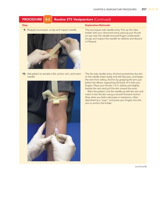 CHAPTER 8: VENIPUNCTURE PROCEDURES 257
Step Explanation/Rationale
PROCEDURE 8-2 Routine ETS Venipuncture (Continued)
9. Reapply tourniquet, uncap and inspect needle. The tourniquet aids needle entry. Pick up the tube
holder with your dominant hand, placing your thumb
on top near the needle end and ﬁngers underneath.
Uncap and inspect the needle for defects and discard
it if ﬂawed.
10. Ask patient to remake a ﬁst, anchor vein, and insert The ﬁst aids needle entry. Anchoring stretches the skin
needle. so the needle enters easily and with less pain, and keeps
the vein from rolling. Anchor by grasping the arm just
below the elbow, supporting the back of it with your
ﬁngers. Place your thumb 1–2 in. below and slightly
beside the vein and pull the skin toward the wrist.
Warn the patient. Line the needle up with the vein and
insert it into the skin using a smooth forward motion.
Stop when you feel a decrease in resistance, often
described as a “pop,” and press your ﬁngers into the
arm to anchor the holder.
(continued)
 