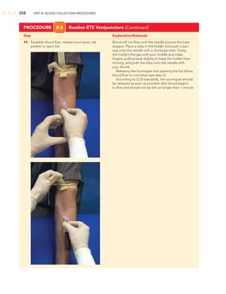 258 UNIT III: BLOOD COLLECTION PROCEDURES
11. Establish blood ﬂow, release tourniquet, ask Blood will not ﬂow until the needle pierces the tube
patient to open ﬁst. stopper. Place a tube in the holder and push it part
way onto the needle with a clockwise twist. Grasp
the holder’s ﬂanges with your middle and index
ﬁngers, pulling back slightly to keep the holder from
moving, and push the tube onto the needle with
your thumb.
Releasing the tourniquet and opening the ﬁst allows
blood ﬂow to normalize (see step 6).
According to CLSI standards, the tourniquet should
be released as soon as possible after blood begins
to ﬂow and should not be left on longer than 1 minute.
Step Explanation/Rationale
PROCEDURE 8-2 Routine ETS Venipuncture (Continued)
 