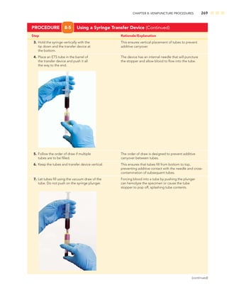 CHAPTER 8: VENIPUNCTURE PROCEDURES 269
Step Rationale/Explanation
PROCEDURE 8-5 Using a Syringe Transfer Device (Continued)
3. Hold the syringe vertically with the This ensures vertical placement of tubes to prevent
tip down and the transfer device at additive carryover.
the bottom.
4. Place an ETS tube in the barrel of The device has an internal needle that will puncture
the transfer device and push it all the stopper and allow blood to ﬂow into the tube.
the way to the end.
5. Follow the order of draw if multiple The order of draw is designed to prevent additive
tubes are to be ﬁlled. carryover between tubes.
6. Keep the tubes and transfer device vertical. This ensures that tubes ﬁll from bottom to top,
preventing additive contact with the needle and cross-
contamination of subsequent tubes.
7. Let tubes ﬁll using the vacuum draw of the Forcing blood into a tube by pushing the plunger
tube. Do not push on the syringe plunger. can hemolyze the specimen or cause the tube
stopper to pop off, splashing tube contents.
(continued)
 