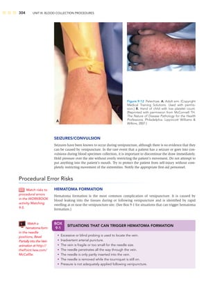 304 UNIT III: BLOOD COLLECTION PROCEDURES
SEIZURES/CONVULSION
Seizures have been known to occur during venipuncture, although there is no evidence that they
can be caused by venipuncture. In the rare event that a patient has a seizure or goes into con-
vulsions during blood specimen collection, it is important to discontinue the draw immediately.
Hold pressure over the site without overly restricting the patient’s movement. Do not attempt to
put anything into the patient’s mouth. Try to protect the patient from self-injury without com-
pletely restricting movement of the extremities. Notify the appropriate ﬁrst-aid personnel.
Procedural Error Risks
HEMATOMA FORMATION
Hematoma formation is the most common complication of venipuncture. It is caused by
blood leaking into the tissues during or following venipuncture and is identiﬁed by rapid
swelling at or near the venipuncture site. (See Box 9-1 for situations that can trigger hematoma
formation.)
Match risks to
procedural errors
in the WORKBOOK
activity Matching
9-5.
A
B
Figure 9-12 Petechiae. A. Adult arm. (Copyright
Medical Training Solutions. Used with permis-
sion.) B. Hand of child with low platelet count.
(Reprinted with permission from McConnell TH.
The Nature of Disease Pathology for the Health
Professions. Philadelphia: Lippincott Williams 
Wilkins, 2007.)
BOX
9-1
SITUATIONS THAT CAN TRIGGER HEMATOMA FORMATION
• Excessive or blind probing is used to locate the vein.
• Inadvertent arterial puncture.
• The vein is fragile or too small for the needle size.
• The needle penetrates all the way through the vein.
• The needle is only partly inserted into the vein.
• The needle is removed while the tourniquet is still on.
• Pressure is not adequately applied following venipuncture.
Watch a
hematoma form
in the needle
positions, Bevel
Partially into the Vein
animation at http://
thePoint.lww.com/
McCall5e.
 
