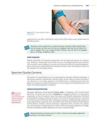 CHAPTER 9: PREANALYTICAL CONSIDERATIONS 307
supporting the arm with a rolled towel can be used to help achieve proper positioning of a
bedridden patient.
Sometimes, when venipuncture is performed using a butterﬂy, blood initially ﬂows
into the tubing, but then some of it starts to disappear back into the vein before the
tube is engaged. This is an example of reﬂux; however, since the tube is not engaged,
there is no danger of additive reﬂux.
VEIN DAMAGE
Properly performed, an occasional venipuncture will not impair the patency of a patient’s
vein. Numerous venipunctures in the same area over an extended period of time, however,
will eventually cause a buildup of scar tissue and increase the difﬁculty of performing subse-
quent venipunctures. Blind probing and improper technique when redirecting the needle can
also damage veins and impair patency.
Specimen Quality Concerns
The quality of a blood specimen can be compromised by improper collection techniques. A
poor-quality specimen will generally yield poor-quality results, which can affect the patient’s
care. Because it is not always apparent to the phlebotomist or testing personnel when the
quality of a specimen has been compromised, it is very important for the phlebotomist to be
aware of the following pitfalls of collection.
HEMOCONCENTRATION
Tourniquet application causes localized venous stasis, or stagnation of the normal venous
blood ﬂow. (A similar term for this is venostasis, the trapping of blood in an extremity by
compression of veins.) In response, some of the plasma and ﬁlterable components of the blood
pass through the capillary walls into the tissues. This results in hemoconcentration, a decrease
in the ﬂuid content of the blood with a subsequent increase in nonﬁlterable large molecule or
protein-based blood components such as red blood cells. Other abnormally increased analytes
include albumin, ammonia, calcium, cholesterol, coagulation factors, enzymes, iron, potassi-
um, and total protein. Changes that occur within 1 minute of tourniquet application are slight;
however, prolonged tourniquet application can lead to marked changes.
Cholesterol levels can increase up to 5% after 2 minutes of tourniquet application
and up to 15% after 5 minutes.
Test your
knowledge of
hemoconcentration
with Knowledge
Drill 9-5 in the
WORKBOOK.
Figure 9-13 Correct ﬁlling of tube to
avoid reﬂux.
 