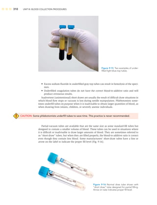 310 UNIT III: BLOOD COLLECTION PROCEDURES
• Excess sodium ﬂuoride in underﬁlled gray-top tubes can result in hemolysis of the speci-
men.
• Underﬁlled coagulation tubes do not have the correct blood-to-additive ratio and will
produce erroneous results.
Inadvertent (unintentional) short draws are usually the result of difﬁcult draw situations in
which blood ﬂow stops or vacuum is lost during needle manipulation. Phlebotomists some-
times underﬁll tubes on purpose when it is inadvisable to obtain larger quantities of blood, as
when drawing from infants, children, or severely anemic individuals.
CAUTION: Some phlebotomists underﬁll tubes to save time. This practice is never recommended.
Partial-vacuum tubes are available that are the same size as some standard-ﬁll tubes but
designed to contain a smaller volume of blood. These tubes can be used in situations where
it is difﬁcult or inadvisable to draw larger amounts of blood. They are sometimes referred to
as “short-draw” tubes, but when they are ﬁlled properly, the blood-to-additive ratio is correct
even though they contain less blood. Some manufacturers’ short-draw tubes have a line or
arrow on the label to indicate the proper ﬁll level (Fig. 9-16).
Figure 9-15 Two examples of under-
ﬁlled light blue–top tubes.
Figure 9-16 Normal draw tube shown with
“short draw” tube designed for partial ﬁlling.
Arrow on tube indicates proper ﬁll level.
 