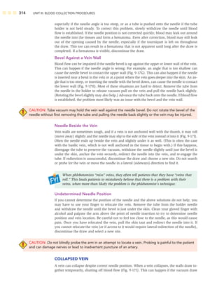 314 UNIT III: BLOOD COLLECTION PROCEDURES
especially if the needle angle is too steep, or as a tube is pushed onto the needle if the tube
holder is not held steady. To correct this problem, slowly withdraw the needle until blood
ﬂow is established. If the needle position is not corrected quickly, blood may leak out around
the needle into the tissues and form a hematoma. Even after correction, blood may still leak
out of the opening caused by the needle, especially if the tourniquet is left on throughout
the draw. This too can result in a hematoma that is not apparent until long after the draw is
completed. If a hematoma is visible, discontinue the draw.
Bevel Against a Vein Wall
Blood ﬂow can be impaired if the needle bevel is up against the upper or lower wall of the vein.
This can happen if the needle angle is wrong. For example, an angle that is too shallow can
cause the needle bevel to contact the upper wall (Fig. 9-17G). This can also happen if the needle
is inserted near a bend in the vein or at a point where the vein goes deeper into the skin. An an-
gle that is too steep, or inserting the needle with the bevel down, can cause the needle to contact
the lower wall (Fig. 9-17H). Most of these situations are hard to detect. Remove the tube from
the needle in the holder to release vacuum pull on the vein and pull the needle back slightly.
(Rotating the bevel slightly may also help.) Advance the tube back onto the needle. If blood ﬂow
is established, the problem most likely was an issue with the bevel and the vein wall.
CAUTION: Tube vacuum may hold the vein wall against the needle bevel. Do not rotate the bevel of the
needle without ﬁrst removing the tube and pulling the needle back slightly or the vein may be injured.
Needle Beside the Vein
Vein walls are sometimes tough, and if a vein is not anchored well with the thumb, it may roll
(move away) slightly and the needle may slip to the side of the vein instead of into it (Fig. 9-17I).
Often the needle ends up beside the vein and slightly under it as well. (This is often the case
with the basilic vein, which is not well anchored in the tissue to begin with.) If this happens,
disengage the tube to preserve the vacuum, withdraw the needle slightly until just the bevel is
under the skin, anchor the vein securely, redirect the needle into the vein, and re-engage the
tube. If redirection is unsuccessful, discontinue the draw and choose a new site. Do not search
or probe for the vein or move the needle in a lateral (sideways) direction to ﬁnd it.
When phlebotomists “miss” veins, they often tell patients that they have “veins that
roll.” This leads patients to mistakenly believe that there is a problem with their
veins, when more than likely the problem is the phlebotomist’s technique.
Undetermined Needle Position
If you cannot determine the position of the needle and the above solutions do not help, you
may have to use your ﬁnger to relocate the vein. Remove the tube from the holder needle
and withdraw the needle until the bevel is just under the skin. Clean your gloved ﬁnger with
alcohol and palpate the arm above the point of needle insertion to try to determine needle
position and vein location. Be careful not to feel too close to the needle, as this would cause
pain. Once you have relocated the vein, pull the skin taut and redirect the needle into it. If
you cannot relocate the vein (or if access to it would require lateral redirection of the needle),
discontinue the draw and select a new site.
CAUTION: Do not blindly probe the arm in an attempt to locate a vein. Probing is painful to the patient
and can damage nerves or lead to inadvertent puncture of an artery.
COLLAPSED VEIN
A vein can collapse despite correct needle position. When a vein collapses, the walls draw to-
gether temporarily, shutting off blood ﬂow (Fig. 9-17J). This can happen if the vacuum draw
 