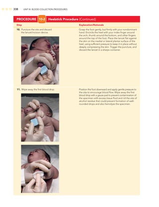 338 UNIT III: BLOOD COLLECTION PROCEDURES
Step Explanation/Rationale
10. Puncture the site and discard Grasp the foot gently, but ﬁrmly with your nondominant
the lancet/incision device. hand. Encircle the heel with your index ﬁnger around
the arch, thumb around the bottom, and other ﬁngers
around the top of the foot. Place the lancet ﬂat against
the skin on the medial or lateral plantar surface of the
heel, using sufﬁcient pressure to keep it in place without
deeply compressing the skin. Trigger the puncture, and
discard the lancet in a sharps container.
PROCEDURE 10-2 Heelstick Procedure (Continued)
11. Wipe away the ﬁrst blood drop. Position the foot downward and apply gentle pressure to
the site to encourage blood ﬂow. Wipe away the ﬁrst
blood drop with a gauze pad to prevent contamination of
the specimen with excess tissue ﬂuid and rid the site of
alcohol residue that could prevent formation of well-
rounded drops and also hemolyze the specimen.
 