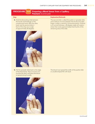 CHAPTER 10: CAPILLARY PUNCTURE EQUIPMENT AND PROCEDURES 349
Step Explanation/Rationale
4. Hold the blood drop slide between The second slide is called the pusher or spreader slide
the thumb and foreﬁnger of the and is held at one end, between the thumb and index
nondominant hand. With the other ﬁnger in either a vertical or horizontal position. If blood
hand, rest the second slide in is of normal thickness, a 30-degree angle will create a
front of the drop at an angle smear that covers approximately three fourths of the
of approximately 30 degrees. remaining area of the slide.
PROCEDURE 10-5 Preparing a Blood Smear from a Capillary
Puncture (Continued)
5. Pull the spreader slide back to the edge The blood must spread the width of the pusher slide
of the blood drop. Stop it as soon as it or a bullet-shaped ﬁlm will result.
touches the drop, and allow the blood
to spread along its width.
(continued)
 