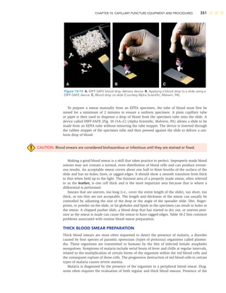 CHAPTER 10: CAPILLARY PUNCTURE EQUIPMENT AND PROCEDURES 351
To prepare a smear manually from an EDTA specimen, the tube of blood must ﬁrst be
mixed for a minimum of 2 minutes to ensure a uniform specimen. A plain capillary tube
or pipet is then used to dispense a drop of blood from the specimen tube onto the slide. A
device called DIFF-SAFE (Fig. 10-15A–C) (Alpha Scientiﬁc, Malvern, PA) allows a slide to be
made from an EDTA tube without removing the tube stopper. The device is inserted through
the rubber stopper of the specimen tube and then pressed against the slide to deliver a uni-
form drop of blood.
CAUTION: Blood smears are considered biohazardous or infectious until they are stained or ﬁxed.
Making a good blood smear is a skill that takes practice to perfect. Improperly made blood
smears may not contain a normal, even distribution of blood cells and can produce errone-
ous results. An acceptable smear covers about one half to three fourths of the surface of the
slide and has no holes, lines, or jagged edges. It should show a smooth transition from thick
to thin when held up to the light. The thinnest area of a properly made smear, often referred
to as the feather, is one cell thick and is the most important area because that is where a
differential is performed.
Smears that are uneven, too long (i.e., cover the entire length of the slide), too short, too
thick, or too thin are not acceptable. The length and thickness of the smear can usually be
controlled by adjusting the size of the drop or the angle of the spreader slide. Dirt, ﬁnger-
prints, or powder on the slide, or fat globules and lipids in the specimen can result in holes in
the smear. A chipped pusher slide, a blood drop that has started to dry out, or uneven pres-
sure as the smear is made can cause the smear to have ragged edges. Table 10-2 lists common
problems associated with routine blood smear preparation.
THICK BLOOD SMEAR PREPARATION
Thick blood smears are most often requested to detect the presence of malaria, a disorder
caused by four species of parasitic sporozoan (types of protozoa) organisms called plasmo-
dia. These organisms are transmitted to humans by the bite of infected female anopheles
mosquitoes. Symptoms of malaria include serial bouts of fever and chills at regular intervals,
related to the multiplication of certain forms of the organism within the red blood cells and
the consequent rupture of those cells. The progressive destruction of red blood cells in certain
types of malaria causes severe anemia.
Malaria is diagnosed by the presence of the organism in a peripheral blood smear. Diag-
nosis often requires the evaluation of both regular and thick blood smears. Presence of the
A B C
Figure 10-15 A. DIFF-SAFE blood drop delivery device. B. Applying a blood drop to a slide using a
DIFF-SAFE device. C. Blood drop on slide (Courtesy Alpha Scientiﬁc, Malvern, PA).
 