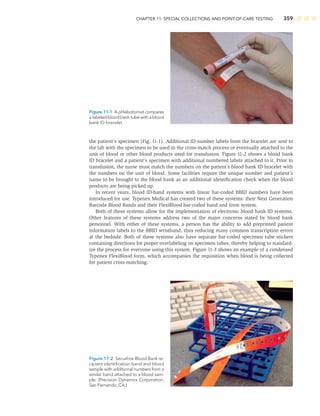 CHAPTER 11: SPECIAL COLLECTIONS AND POINT-OF-CARE TESTING 359
the patient’s specimen (Fig. 11-1). Additional ID-number labels from the bracelet are sent to
the lab with the specimen to be used in the cross-match process or eventually attached to the
unit of blood or other blood products used for transfusion. Figure 11-2 shows a blood bank
ID bracelet and a patient’s specimen with additional numbered labels attached to it. Prior to
transfusion, the nurse must match the numbers on the patient’s blood bank ID bracelet with
the numbers on the unit of blood. Some facilities require the unique number and patient’s
name to be brought to the blood bank as an additional identiﬁcation check when the blood
products are being picked up.
In recent years, blood ID-band systems with linear bar-coded BBID numbers have been
introduced for use. Typenex Medical has created two of these systems: their Next Generation
Barcode Blood Bands and their FlexiBlood bar-coded band and form system.
Both of these systems allow for the implementation of electronic blood bank ID systems.
Other features of these systems address two of the major concerns stated by blood bank
personnel. With either of these systems, a person has the ability to add preprinted patient
information labels to the BBID wristband, thus reducing many common transcription errors
at the bedside. Both of these systems also have separate bar-coded specimen tube stickers
containing directions for proper overlabeling on specimen tubes, thereby helping to standard-
ize the process for everyone using this system. Figure 11-3 shows an example of a condensed
Typenex FlexiBlood form, which accompanies the requisition when blood is being collected
for patient cross-matching.
Figure 11-1 A phlebotomist compares
a labeled blood bank tube with a blood
bank ID bracelet.
Figure 11-2 Securline Blood Bank re-
cipient identiﬁcation band and blood
sample with additional numbers from a
similar band attached to a blood sam-
ple. (Precision Dynamics Corporation,
San Fernando, CA.)
 