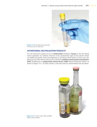 CHAPTER 11: SPECIAL COLLECTIONS AND POINT-OF-CARE TESTING 371
ANTIMICROBIAL NEUTRALIZATION PRODUCTS
It is not unusual for patients to be on antimicrobial (antibiotic) therapy at the time blood
culture specimens are collected. Presence of the antimicrobial agent in the patient’s blood
can inhibit the growth of the microorganisms in the blood culture bottle. In such cases, the
physician may order blood cultures to be collected in fastidious antimicrobial neutralization
(FAN) (bioMerieux) or antimicrobial removal device (ARD) (Becton Dickinson) bottles, as
shown in Figure 11-11. An ARD contains a resin that removes antimicrobials from the blood.
Figure 11-10 A yellow-top tube used
for blood culture collection.
Figure 11-11 Left to right: FAN and ARD
blood culture bottles.
 