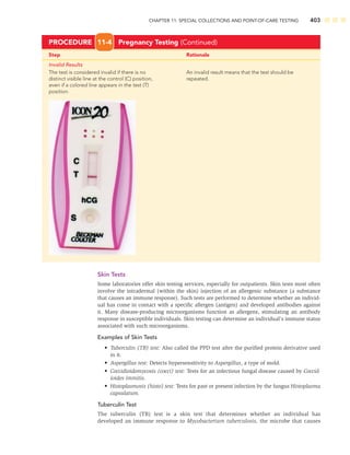 CHAPTER 11: SPECIAL COLLECTIONS AND POINT-OF-CARE TESTING 403
Step Rationale
Invalid Results
The test is considered invalid if there is no An invalid result means that the test should be
distinct visible line at the control (C) position, repeated.
even if a colored line appears in the test (T)
position.
PROCEDURE 11-4 Pregnancy Testing (Continued)
Skin Tests
Some laboratories offer skin testing services, especially for outpatients. Skin tests most often
involve the intradermal (within the skin) injection of an allergenic substance (a substance
that causes an immune response). Such tests are performed to determine whether an individ-
ual has come in contact with a speciﬁc allergen (antigen) and developed antibodies against
it. Many disease-producing microorganisms function as allergens, stimulating an antibody
response in susceptible individuals. Skin testing can determine an individual’s immune status
associated with such microorganisms.
Examples of Skin Tests
• Tuberculin (TB) test: Also called the PPD test after the puriﬁed protein derivative used
in it.
• Aspergillus test: Detects hypersensitivity to Aspergillus, a type of mold.
• Coccidioidomycosis (cocci) test: Tests for an infectious fungal disease caused by Coccid-
ioides immitis.
• Histoplasmosis (histo) test: Tests for past or present infection by the fungus Histoplasma
capsulatum.
Tuberculin Test
The tuberculin (TB) test is a skin test that determines whether an individual has
developed an immune response to Mycobacterium tuberculosis, the microbe that causes
 