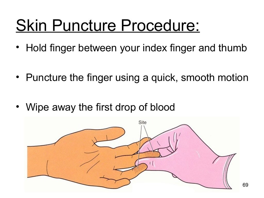 Phlebotomy for Medical Laboratory Professionals