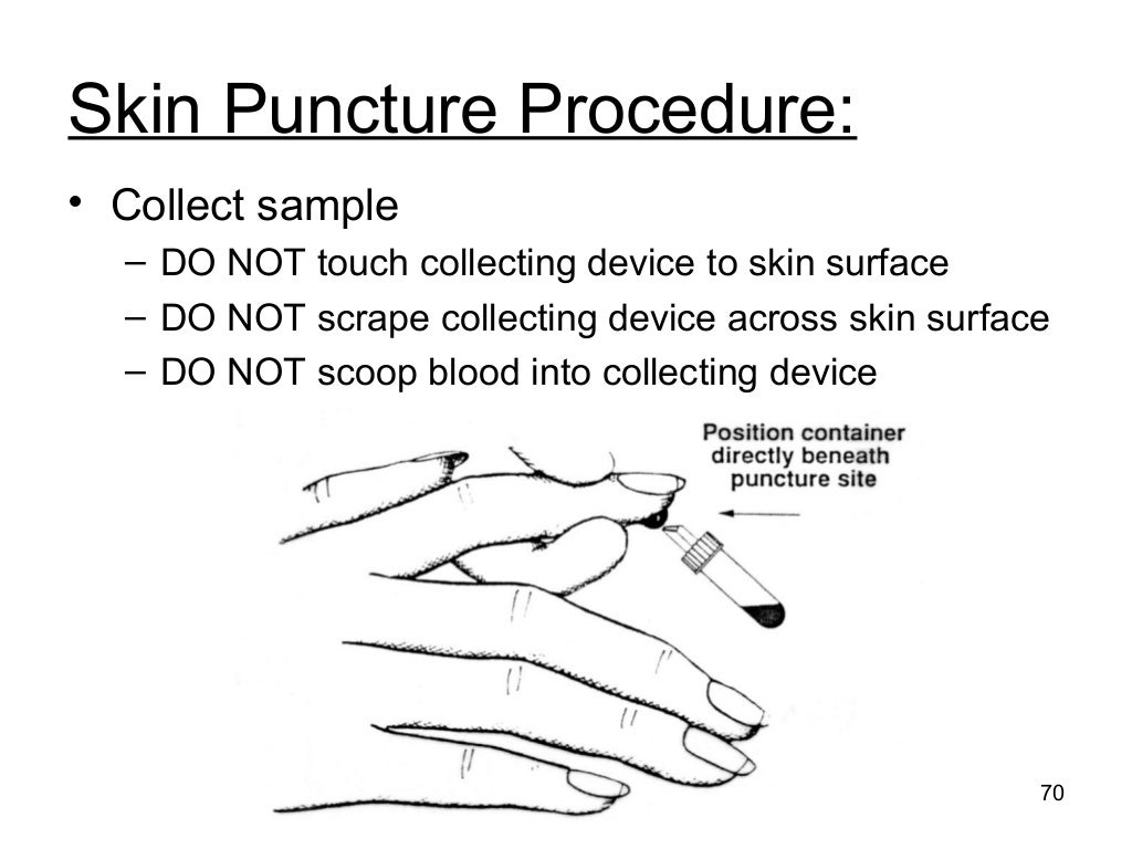 Phlebotomy for Medical Laboratory Professionals