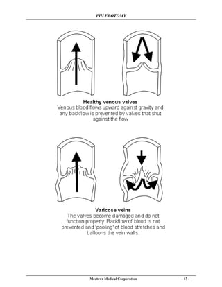 PHLEBOTOMY
Medtexx Medical Corporation - 17 -
 