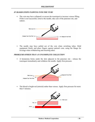 PHLEBOTOMY
Medtexx Medical Corporation - 38 -
IF BLOOD STOPS FLOWING INTO THE TUBE
The vein may have collapsed; re-secure the tourniquet to increase venous filling.
If this is not successful, remove the needle, take care of the puncture site, and
redraw.
The needle may have pulled out of the vein when switching tubes. Hold
equipment firmly and place fingers against patient's arm, using the flange for
leverage when withdrawing and inserting tubes.
PROBLEMS OTHER THAN AN INCOMPLETE COLLECTION
A hematoma forms under the skin adjacent to the puncture site - release the
tourniquet immediately and withdraw the needle. Apply firm pressure.
The blood is bright red (arterial) rather than venous. Apply firm pressure for more
than 5 minutes.
 