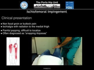 The Porto Hip Unit
PHM2015
Ischiofemoral Impingement
! Non focal groin or buttock pain 
! Ischialgia with radiation to the medial thigh
! Painful popping, difficult to localize 
! Often diagnosed as “snapping iliopsoas”
Clinical presentation
 