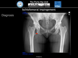The Porto Hip Unit
PHM2015
Ischiofemoral Impingement
!
Diagnosis
 