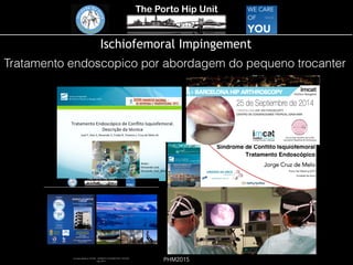 The Porto Hip Unit
PHM2015
Ischiofemoral Impingement
Tratamento endoscopico por abordagem do pequeno trocanter
 