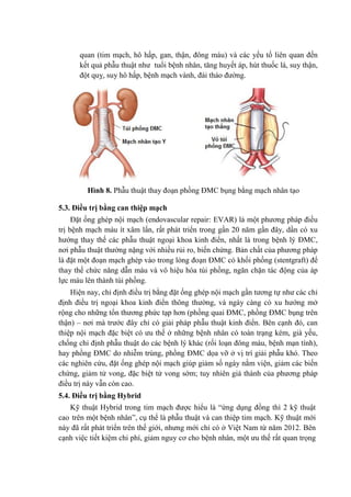 quan (tim mạch, hô hấp, gan, thận, đông máu) và các yếu tố liên quan đến
kết quả phẫu thuật như tuổi bệnh nhân, tăng huyết áp, hút thuốc lá, suy thận,
đột quỵ, suy hô hấp, bệnh mạch vành, đái tháo đường.
Hình 8. Phẫu thuật thay đoạn phồng ĐMC bụng bằng mạch nhân tạo
5.3. Điều trị bằng can thiệp mạch
Đặt ống ghép nội mạch (endovascular repair: EVAR) là một phương pháp điều
trị bệnh mạch máu ít xâm lấn, rất phát triển trong gần 20 năm gần đây, dần có xu
hướng thay thế các phẫu thuật ngoại khoa kinh điển, nhất là trong bệnh lý ĐMC,
nơi phẫu thuật thường nặng với nhiều rủi ro, biến chứng. Bản chất của phương pháp
là đặt một đoạn mạch ghép vào trong lòng đoạn ĐMC có khối phồng (stentgraft) để
thay thế chức năng dẫn máu và vô hiệu hóa túi phồng, ngăn chặn tác động của áp
lực máu lên thành túi phồng.
Hiện nay, chỉ định điều trị bằng đặt ống ghép nội mạch gần tương tự như các chỉ
định điều trị ngoại khoa kinh điển thông thường, và ngày càng có xu hướng mở
rộng cho những tổn thương phức tạp hơn (phồng quai ĐMC, phồng ĐMC bụng trên
thận) – nơi mà trước đây chỉ có giải pháp phẫu thuật kinh điển. Bên cạnh đó, can
thiệp nội mạch đặc biệt có ưu thế ở những bệnh nhân có toàn trạng kém, già yếu,
chống chỉ định phẫu thuật do các bệnh lý khác (rối loạn đông máu, bệnh mạn tính),
hay phồng ĐMC do nhiễm trùng, phồng ĐMC dọa vỡ ở vị trí giải phẫu khó. Theo
các nghiên cứu, đặt ống ghép nội mạch giúp giảm số ngày nằm viện, giảm các biến
chứng, giảm tử vong, đặc biệt tử vong sớm; tuy nhiên giá thành của phương pháp
điều trị này vẫn còn cao.
5.4. Điều trị bằng Hybrid
Kỹ thuật Hybrid trong tim mạch được hiểu là “ứng dụng đồng thì 2 kỹ thuật
cao trên một bệnh nhân”, cụ thể là phẫu thuật và can thiệp tim mạch. Kỹ thuật mới
này đã rất phát triển trên thế giới, nhưng mới chỉ có ở Việt Nam từ năm 2012. Bên
cạnh việc tiết kiệm chi phí, giảm nguy cơ cho bệnh nhân, một ưu thế rất quan trọng
 