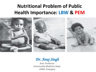 Nutritional Problem of Public
Health Importance: LBW & PEM
Dr. Anuj Singh
Asst. Professor
Community Medicine Dept.
UIMS, Prayagraj
 