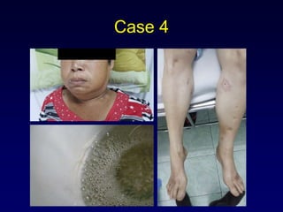 Case 4
 