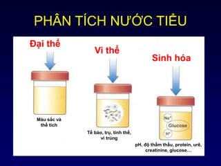 PHÂN TÍCH NƯỚC TIỂU
Vi thể
Đại thể
Sinh hóa
Màu sắc và
thể tích
Tế bào, trụ, tinh thể,
vi trùng
pH, độ thẩm thấu, protein, urê,
creatinine, glucose…
 